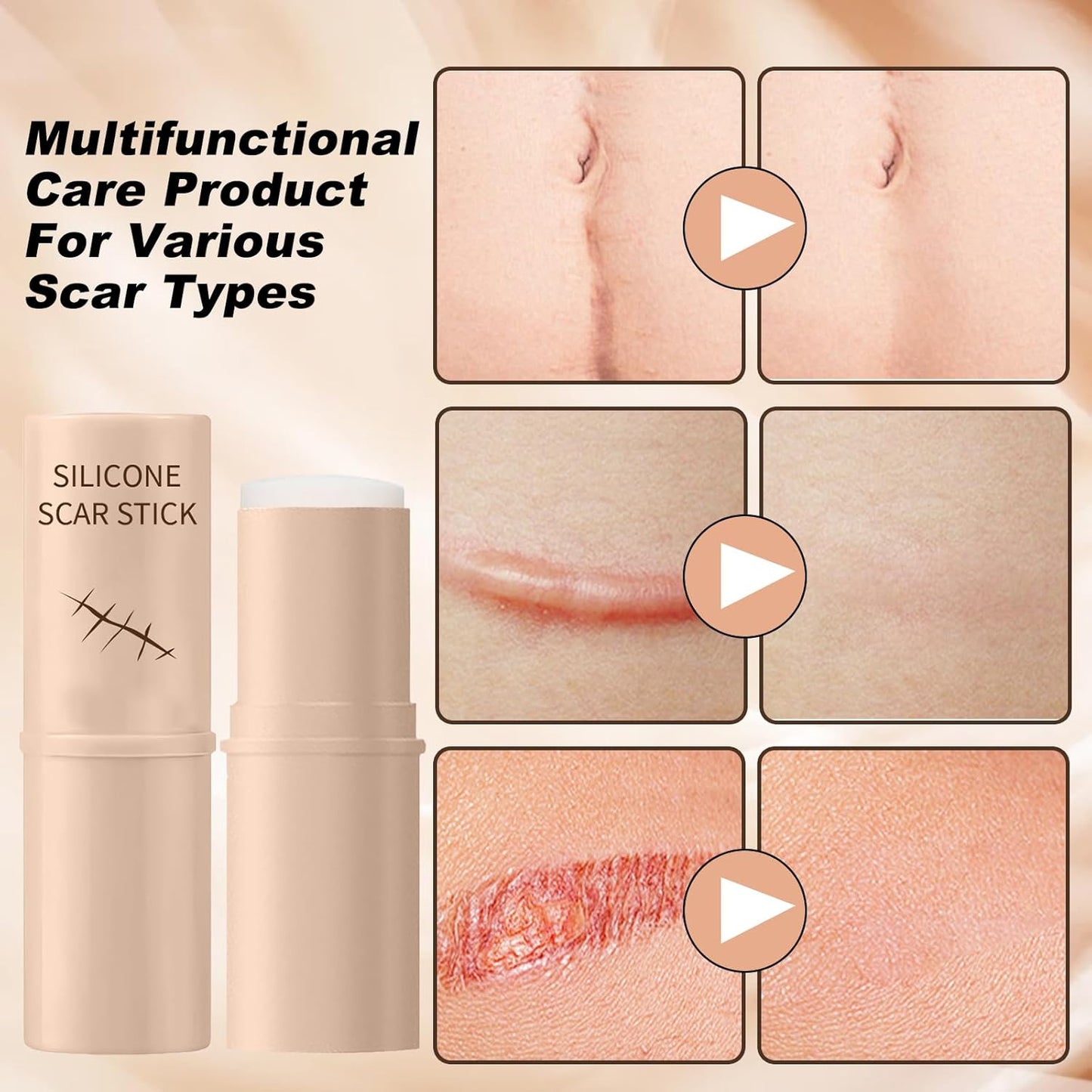 Silicon Scar Removal Stick✨to elevate you Daily Skin Care Recovery