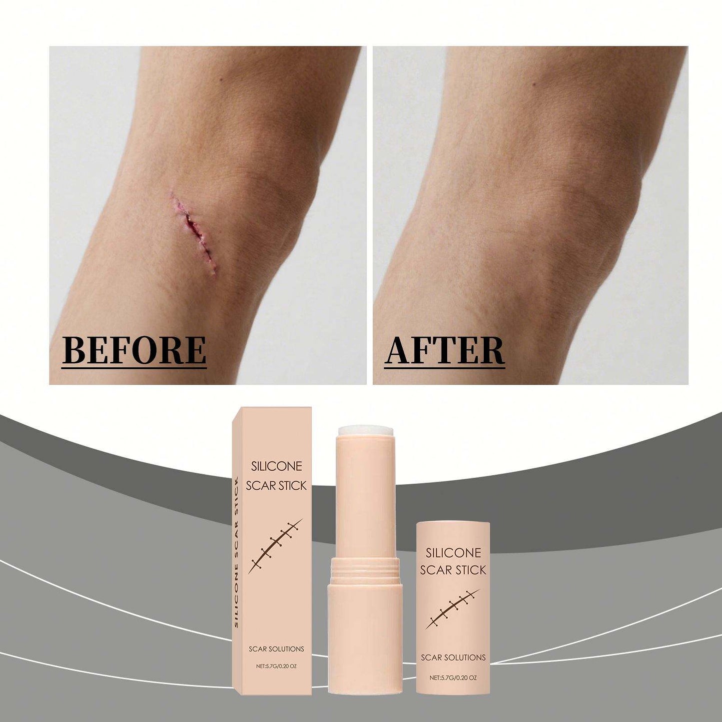 Silicon Scar Removal Stick✨to elevate you Daily Skin Care Recovery