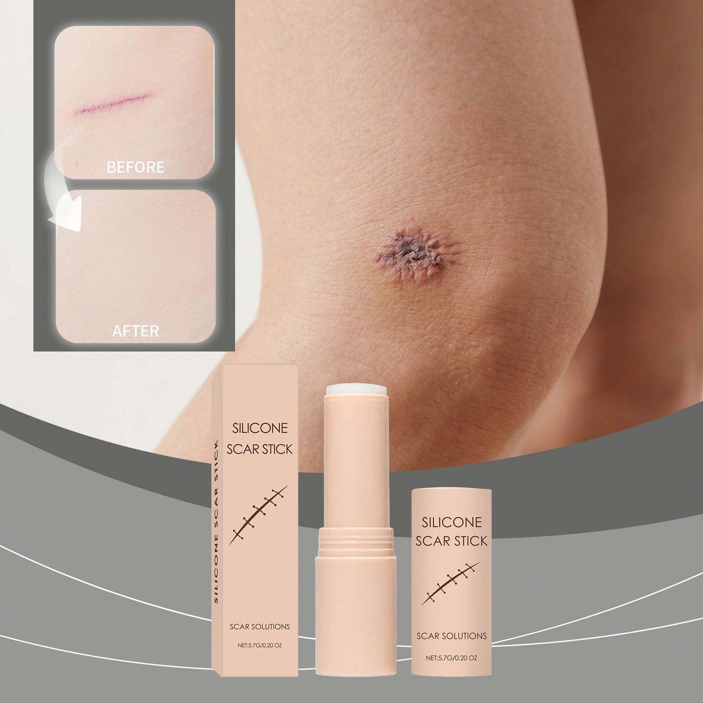 Silicon Scar Removal Stick✨to elevate you Daily Skin Care Recovery